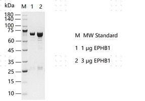 S2301T-H29G EPHB1 Protein&nbsp;@K130419011-做.