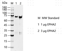 S2301T-H19G EPHA2 Protein&nbsp;@K130403012-做.