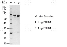 EPHB4 Protein @K130420014-做.jpg