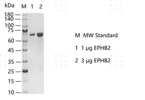 S2301T-H30G EPHB2 Protein&nbsp;@K130419012-做.