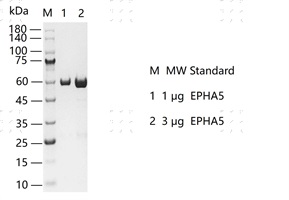 S2301T-H22G EPHA5 Protein @G130418011-做.