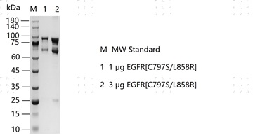S2304T-H31G EGFR[C797S L858R]&nbsp;Protein&nbsp;@K