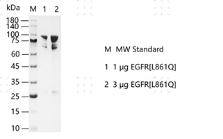 S2304T-H38G EGFR[L861Q] &nbsp;Protein&nbsp;@K13112