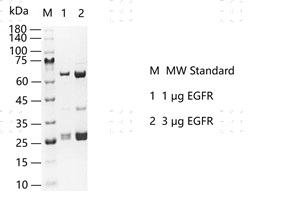 S2301T-H33G EGFR Protein @K130313012-做.j