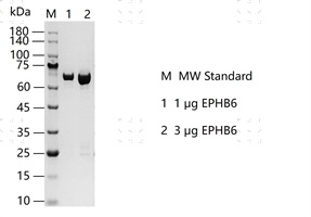 S2304T-H88G EPHB6(inactive) Protein&nbsp;@K13