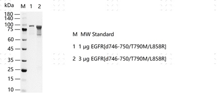 S2304T-H36G EGFR[d746-750+T790M+L858R] &nbsp;
