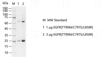 S2301T-H28G EGFR[T790M+C797S+L858R] &nbsp;Pro