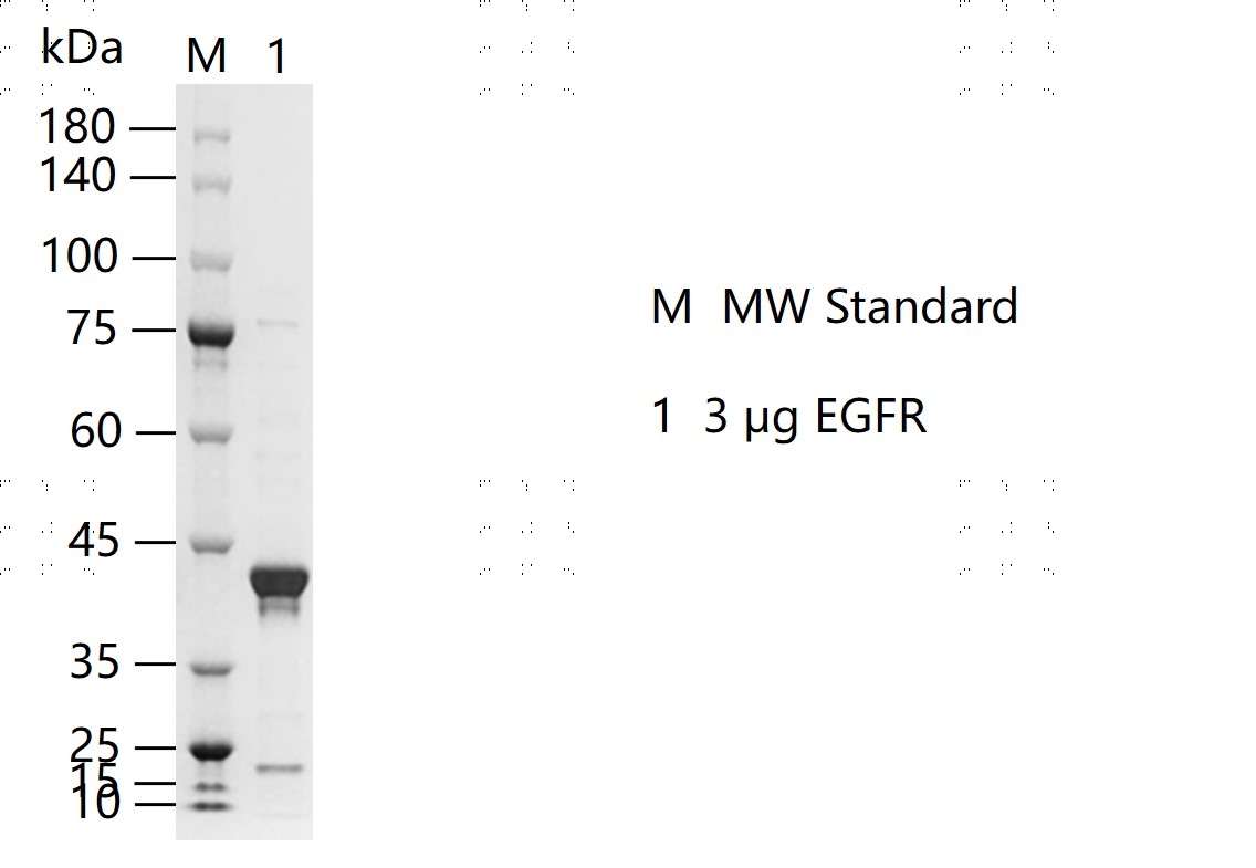 EGFR Protein @K121222021.jpg