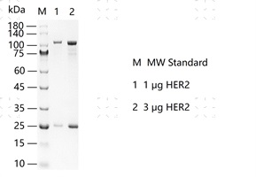 S2302T-H06G HER2&nbsp;Protein&nbsp;@G130619011-做.j