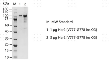 S2309T-H03GS Her2&nbsp;Protein&nbsp;@G131227012-做.