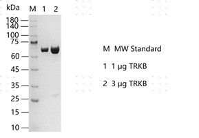 S2302T-H41G TRKB Protein @G130426021-做.j