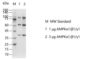 G140807022-AMPKα1β1γ1.png