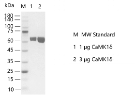 CaMK1δ-H141105022.png