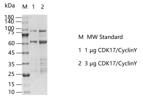 K150427011-CDK17 CyclinY.png