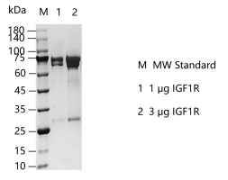 G150411011- IGF1R.png