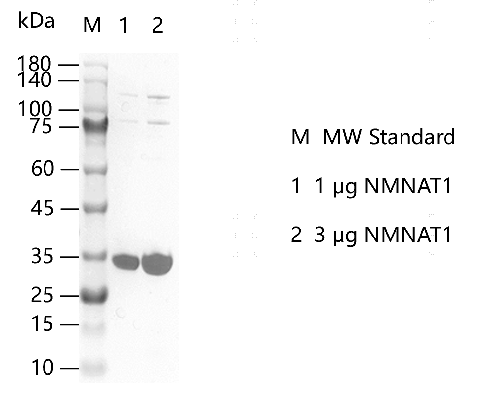 M150221011-NMNAT1.png