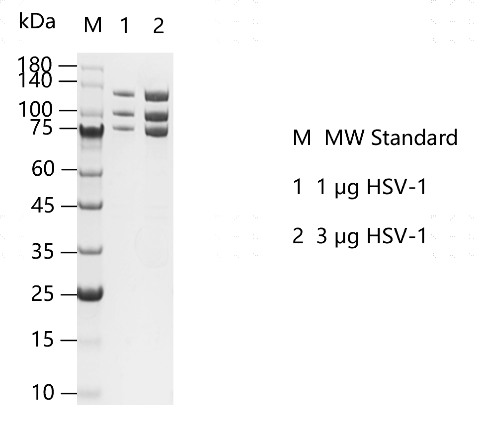 G160113011-HSV-1.png