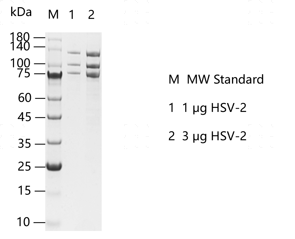 G160109021-HSV-2.png