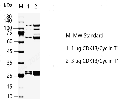 G150520011-CDK13 Cyclin T1.png