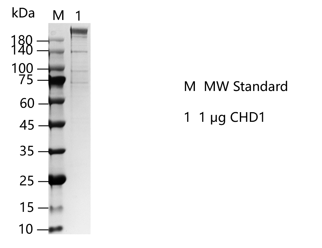 G150704011-CHD1.png