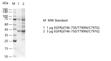 G151211021-EGFR[d746-750 T790M C797G].pn