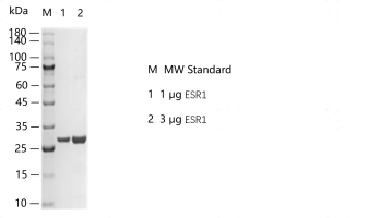 G160520011-ESR1.png