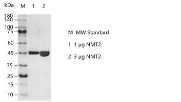 A141122011-NMT2.png